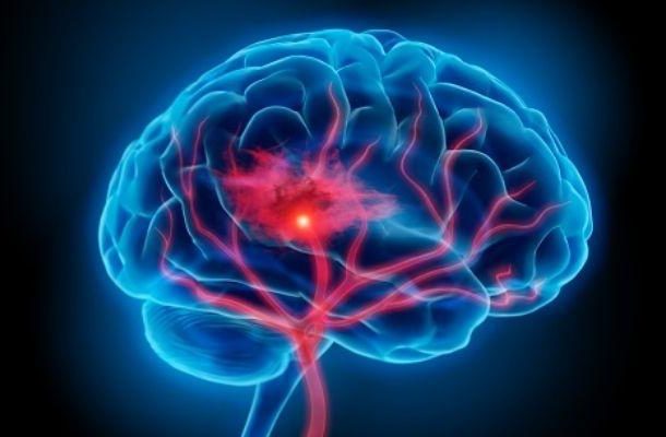 cerebral blood flow